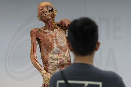 epa13116825 A visitor observes a human anatomy specimen at the Museum of Human Body in Chulalongkorn University in Bangkok, Thailand, 17 July 2026. Opened in mid-2012, Thailand's Museum of Human Body is one of eleven such museums globally and the first in Southeast Asia exhibiting 131 donated specimens preserved through plastination imported from Japan of...