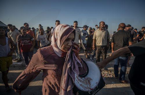 epaselect epa13177711 An injured Palestinian woman following an Israeli airstrike at Gaza port near the beach in Gaza City, 18 August 2026. The Ministry of Health in Gaza said at least six Palestinians were killed and others injured in an Israeli airstrike in western Gaza City.  EPA/MOHAMMED SABER