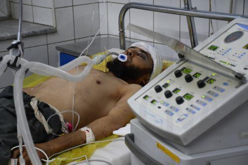 epa12499993 A man who was injured in an earthquake receives treatment at a hospital in Mazar-e-Sharif, Afghanistan, 03 November 2025. At least five people were killed and over 140 injured after a powerful 6.3-magnitude earthquake struck near Mazar-i-Sharif, one of northern Afghanistan’s largest cities, early 03 November, according to the country’s disaster...