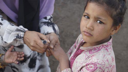 epa12703889 A healthcare worker marks a child's hand following polio vaccination during a door-to-door vaccination campaign in Dera Ismail Khan, Pakistan, 04 February 2026. Pakistan launched its first nationwide anti-polio vaccination drive of the year, aiming to immunize more than 45 million children under the age of five between 02 and 08 February 2026....
