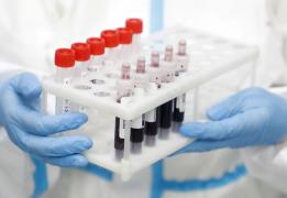 Liver disease is increasing in Europe, f