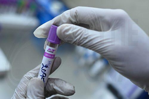 Δοκιμές κυτταρικής ανοσοθεραπείας στο Πανεπιστήμιο Ακντενίζ της Τουρκίας