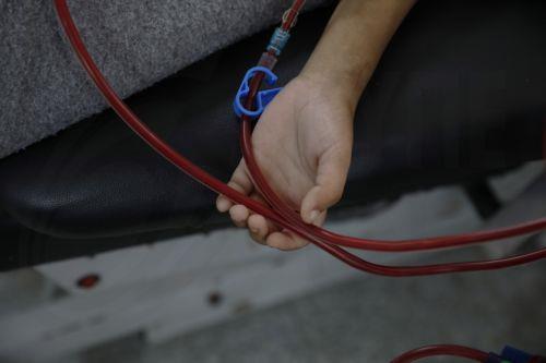 Δύο εταιρίες ξεκινούν κλινικές δοκιμές μεταμόσχευσης νεφρών από χοίρους σε ανθρώπους