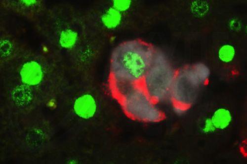 «Προμηθέας»: Ξεκίνησαν οι εξετάσεις ελαστογραφίας ήπατος στο Γερμ. Ιατρικό Ινστιτούτο