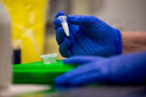 Απόσυρση από κυπριακή αγορά κατεψυγμένου φιλέτου στήθους πάπιας λόγω σαλμονέλας