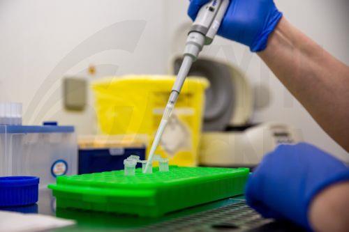 Thyroid cancer in Cyprus among highest, Dr. Kadis tells CNA, no data linking to wars in region