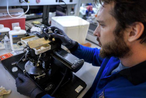 Μελετάται θεραπεία ασθενειών με αντικατάσταση παλαιών ανοσοκυττάρων στον εγκέφαλο