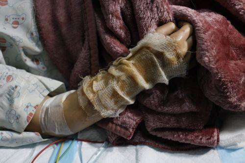 ΠΟΥ: Τα νοσοκομεία Λιβάνου κινδυνεύουν να ξεμείνουν από προμήθειες ιατρικού υλικού σε λίγες μέρες